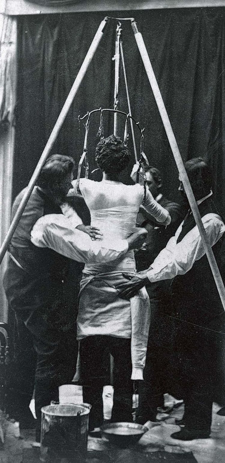 Жуткие медицинские приборы прошлого: как лечили в начале XX века